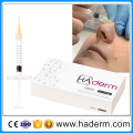 Favorable Price Hyaluronic Acid Filler Injection
